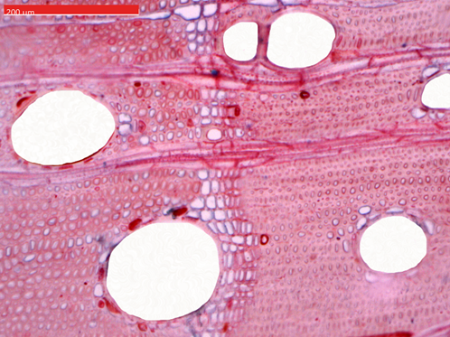Microscope and rings